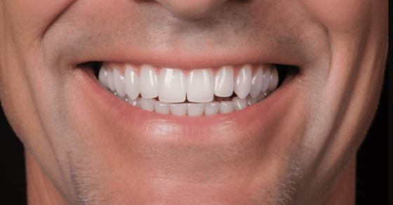 Your Complete Guide to a Perfect Smile: Essential Facts About Modern Dental Implants